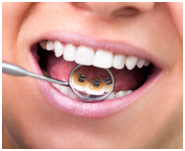lingual-braces