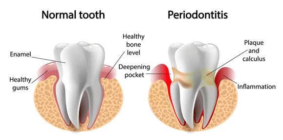 periodontist